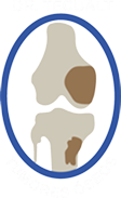 Logo Tumores Óseos
