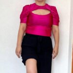 Tumor de células gigantes tratado con plastia con cemento óseo.png